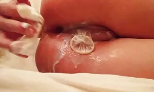 Aku memeriksa diameter dubur, dan ingin memasukkan kesah sex melayu secara manual.